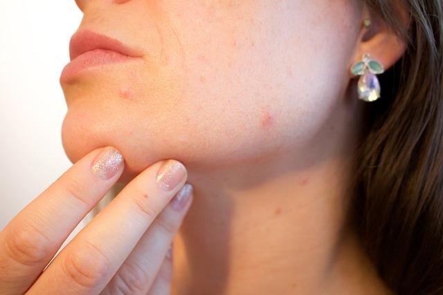 Discover the Best Topical Solutions for Sore Muscles